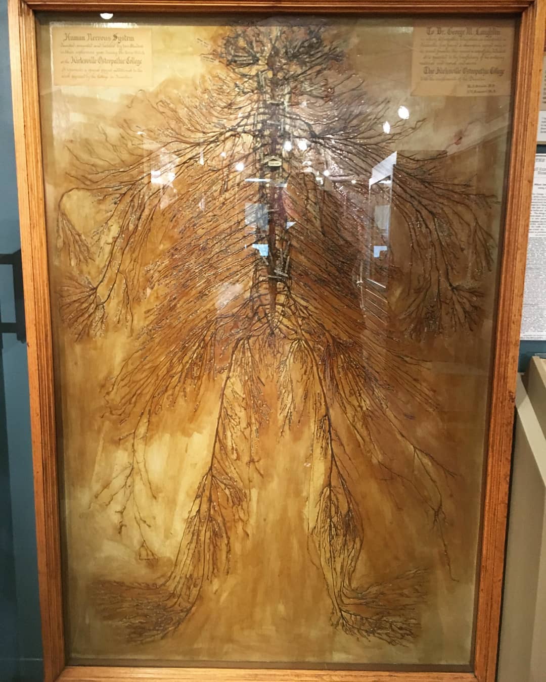 Intact human nervous system that was dissected by 2 medical students in 1925