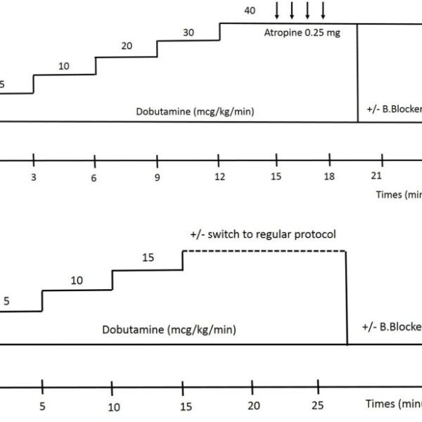 Stress Echocardiography: Concept and Criteria, Structure and Steps, Obstacles and Outcomes, Focused Update and Review